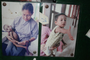 Sister Martha with a sick child, and that same child a few months later.